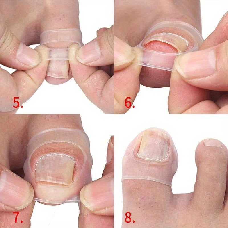 4pcs 2 sets comfortable fitting toenail